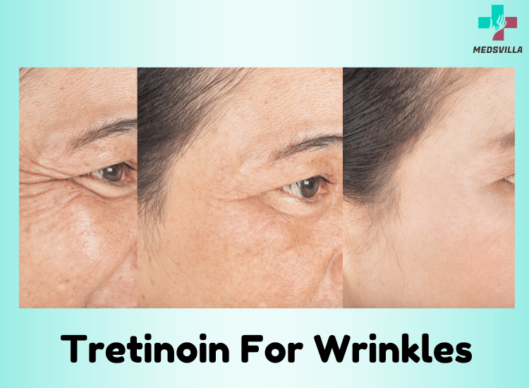 Tretinoin For Wrinkles