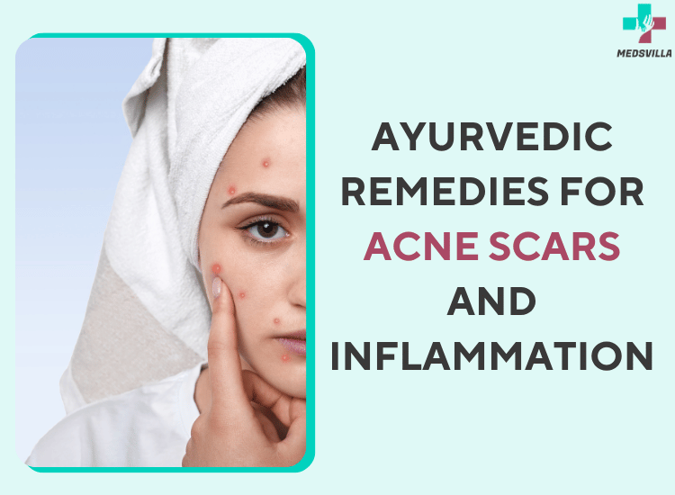 Acne Scars