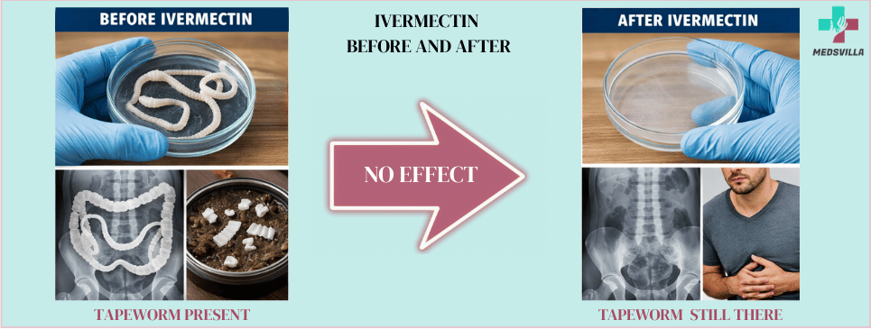 Ivermectin Before and After