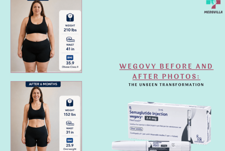 Wegovy Before and After